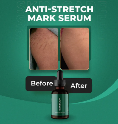 Markaway Stretch Mark Serum – Herbal Formula for Hydration, Skin Toning & Dark Spot Correction